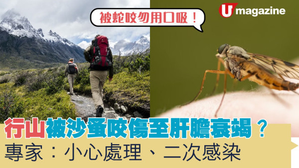 行山被沙蚤咬傷至肝膽衰竭？ 專家：小心處理、二次感染　被蛇咬勿用口吸