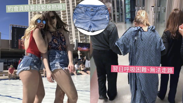 辣妹著熱褲8小時後全身發抖入ICU！引發敗血病 險被切除臀部！