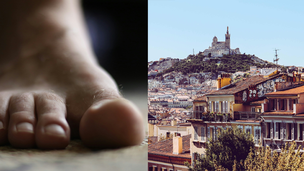 遊法國腳趾頭一夜腫脹發紫 醫生切開狂流膿 難以置信這是「兇手」