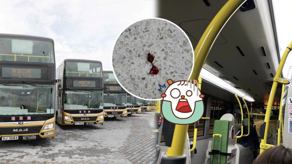 金巴床蝨｜往澳門金巴床蝨滿車 乘客邊坐邊有嘢咬：除鞋超過10隻走出嚟【附金巴回應】