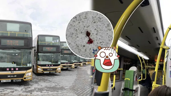 金巴床蝨｜往澳門金巴床蝨滿車 乘客邊坐邊有嘢咬：除鞋超過10隻走出嚟【附金巴回應】