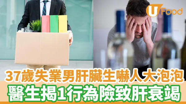 37歲失業男肝臟生大泡泡 醫生揭1行為險致肝衰竭