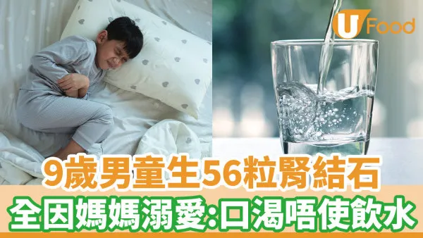 9歲童生56粒腎結石 醫生揭媽媽「溺愛餐單」是元兇:口渴不飲水
