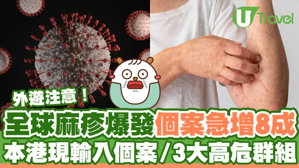 全球麻疹爆發較去年急增近8成！本港現3宗輸入個案／3大高危群組需注意！