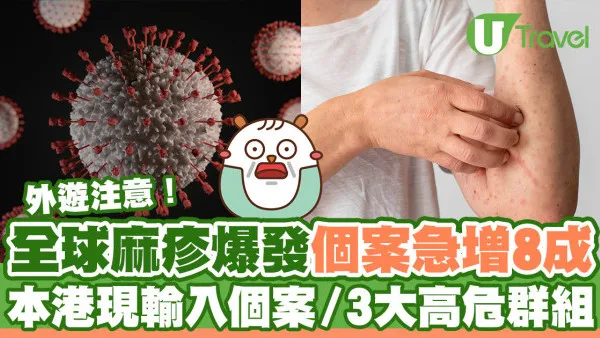 全球麻疹爆發較去年急增近8成！本港現3宗輸入個案／3大高危群組需注意！