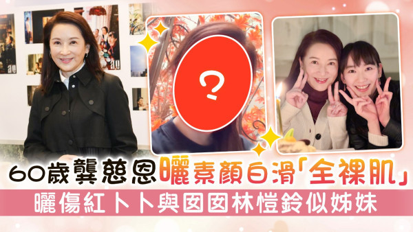 60歲龔慈恩曬素顏白滑「全裸肌」 曬傷紅卜卜與囡囡林愷鈴似姊妹