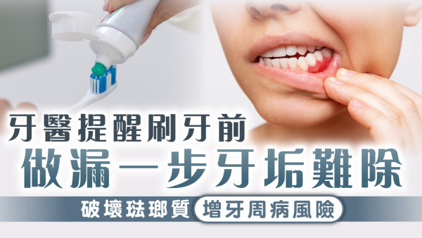 牙齒健康｜牙醫提醒刷牙前做漏一步牙垢難除 破壞琺瑯質增牙周病風險