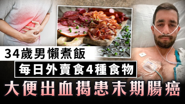 致癌飲食｜34歲男懶煮飯 每日外賣食4種食物 大便出血揭患末期腸癌