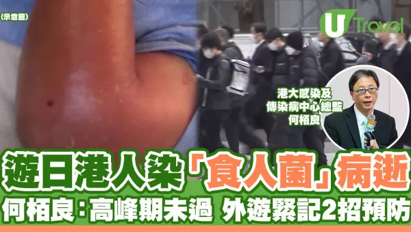遊日港人感染「食人菌」病逝 何栢良：高峰期未過 外遊切記2招預防