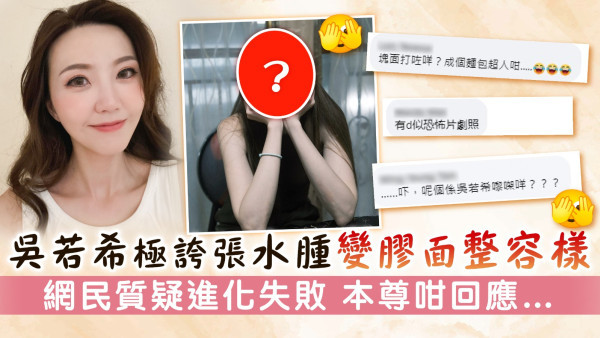 吳若希極誇張水腫變膠面整容樣　網民質疑進化失敗 本尊咁回應…