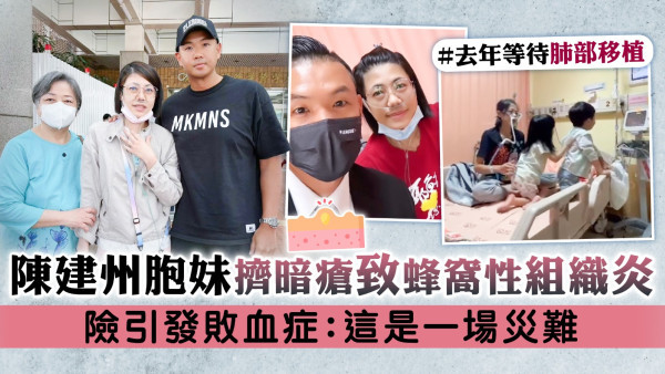 陳建州胞妹擠暗瘡致蜂窩性組織炎 險引發敗血症：這是一場災難