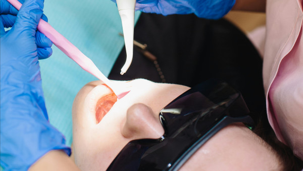 工聯會免費洗牙及補牙優惠！符合1個條件即日起可預約