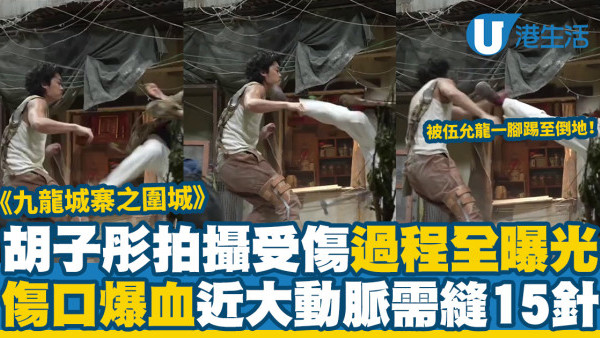 九龍城寨之圍城｜胡子彤拍攝受傷過程全曝光 即場見血事後需縫15針