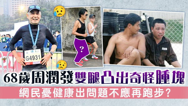 68歲周潤發雙腿凸出奇怪腫塊 網民憂健康出問題不應再跑步？