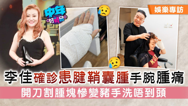 中年好聲音丨李佳確診患腱鞘囊腫手腕腫痛 開刀割腫塊慘變豬手洗唔到頭