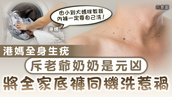 家居衛生｜港媽全身生疣 斥老爺奶奶是元凶 將全家底褲同機洗惹禍