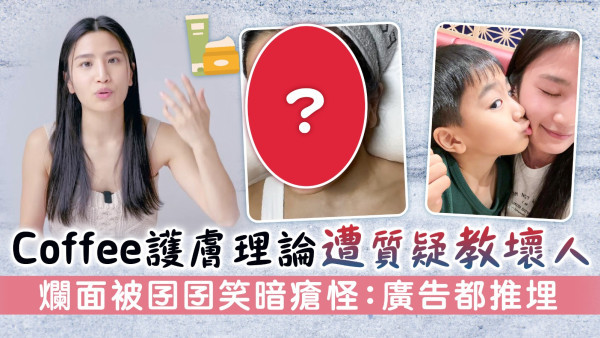 Coffee林芊妤護膚理論遭質疑教壞人 爛面被囝囝笑暗瘡怪：廣告都推埋