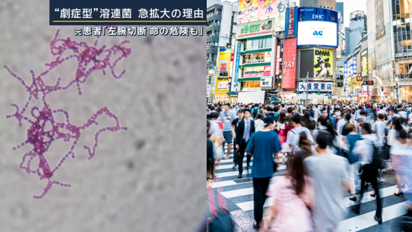 日本「食人菌」持續爆發250人死！千三病例創新高！兩大途徑感染