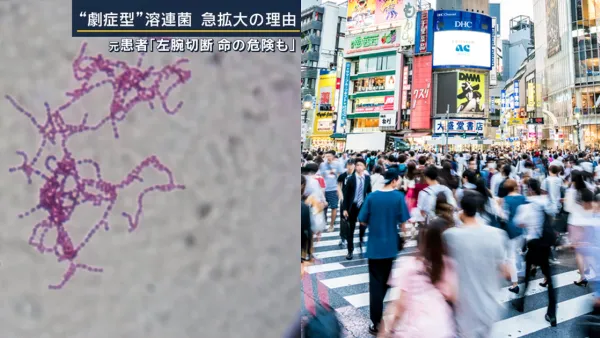 日本「食人菌」持續爆發250人死！千三病例創新高！兩大途徑感染