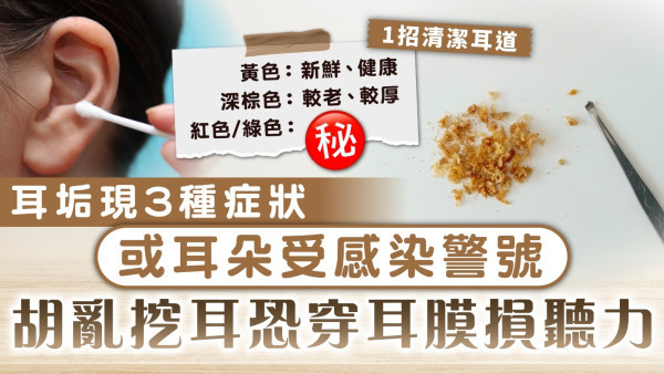 耳朵清潔｜耳垢現3種症狀或耳朵受感染警號 胡亂挖耳恐穿耳膜損聽力