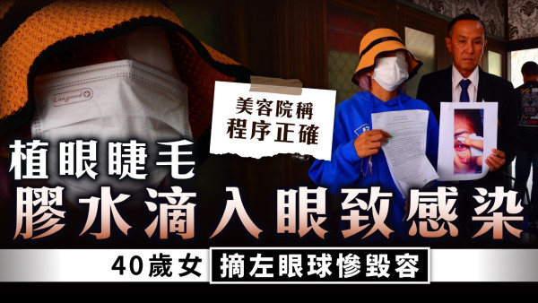 美容意外｜植眼睫毛膠水滴入眼致感染 40歲女摘左眼球慘毀容