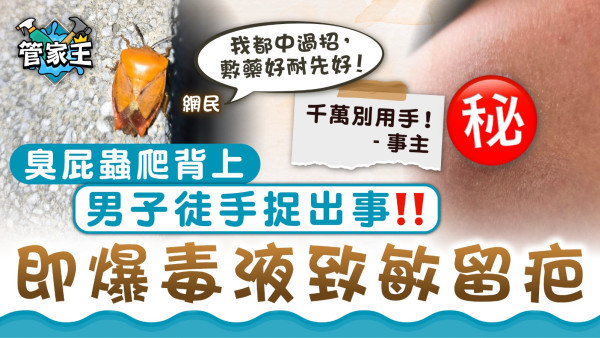臭屁蟲｜臭屁蟲爬背上男子徒手捉出事 即爆毒液致敏留疤