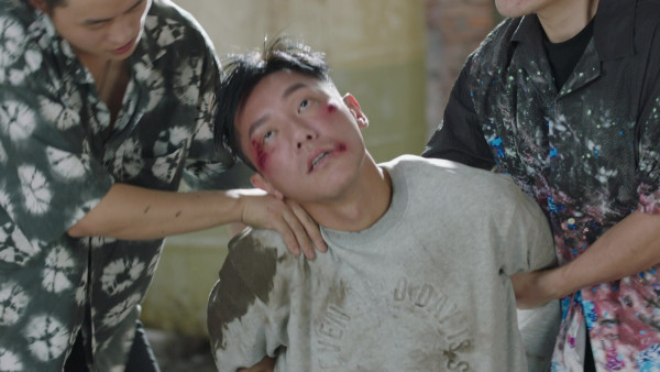 反黑英雄｜張頴康後巷拍追賊戲意外受傷 手指尾後遺症纏繞大半年至今未能伸直