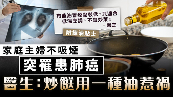 食用安全︱家庭主婦不吸煙突罹患肺癌 醫生：炒餸用一種油惹禍【附揀油貼士】