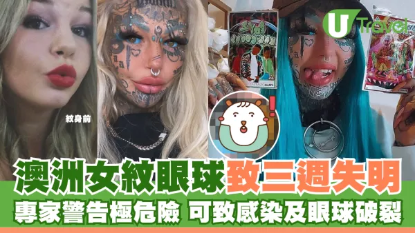 澳洲「青眼白龍」紋身女王Amber Luke 紋眼球致三週失明 稱困擾但值得