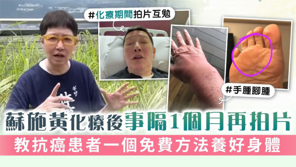 蘇施黃化療後事隔1個月再拍片 教抗癌患者一個免費方法養好身體