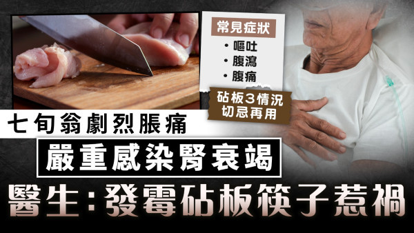 廚房衛生︱七旬翁劇烈脹痛嚴重感染腎衰竭 醫生：發霉砧板筷子惹禍