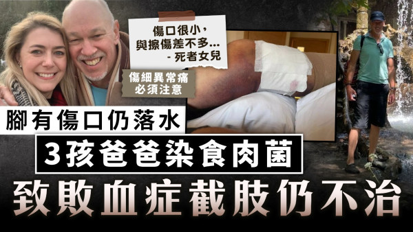食肉菌感染｜腳小傷口落水奪命 3孩爸爸染食肉菌 致敗血症截肢仍不治