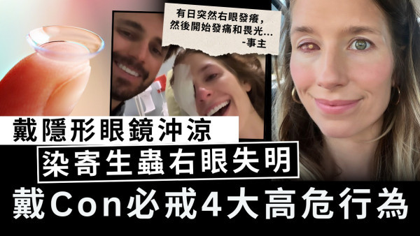 戴Con危機｜女子戴隱形眼鏡沖涼 染寄生蟲右眼失明 戴Con必戒4大高危行為