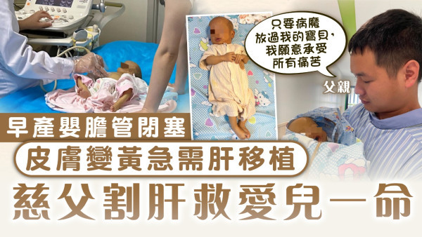 捐肝救子︱早產嬰膽管閉塞 皮膚變黃急需肝移植 慈父割肝救愛兒一命