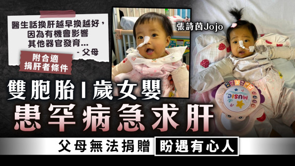 緊急呼籲︱雙胞胎1歲女嬰患罕病急求肝 父母無法捐贈盼遇有心人