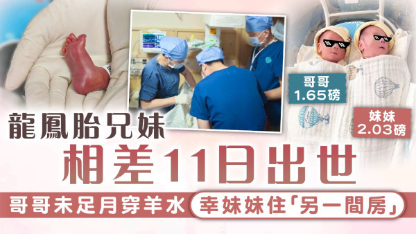 罕見雙胞胎︱龍鳳胎兄妹相差11日出世 哥哥未足月穿羊水 幸妹妹住「另一間房」