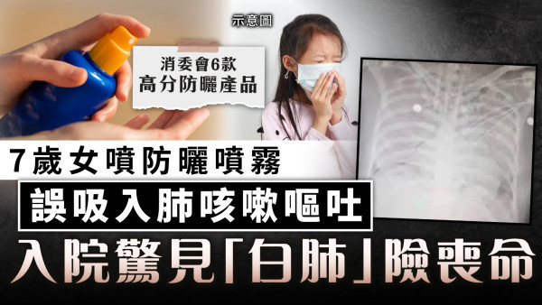 防曬噴霧︱7歲女噴防曬噴霧 誤吸入肺咳嗽嘔吐 入院驚見「白肺」險喪命