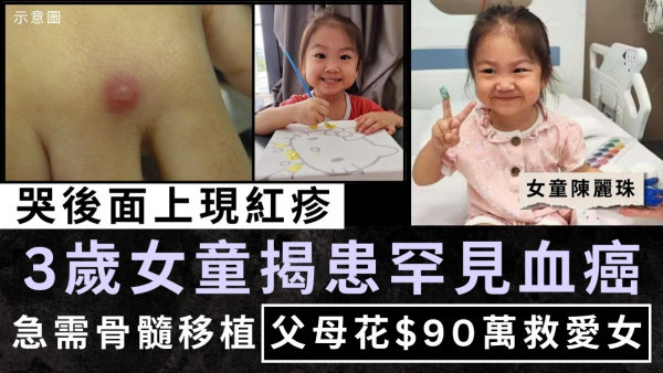 罕見血癌｜哭後面上現「紅疹」 3歲女童揭患罕見血癌 急需骨髓移植父母花$90萬救愛女