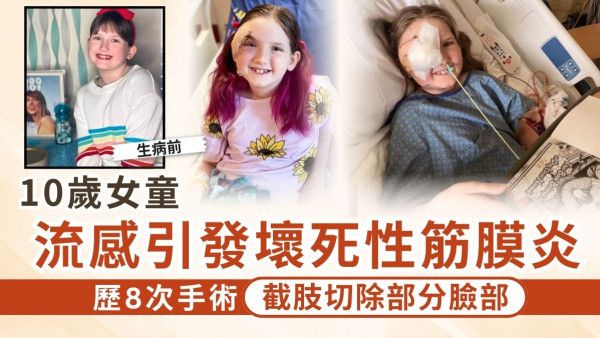 壞死性筋膜炎｜10歲女童流感引發壞死性筋膜炎 歷8次手術截肢切除部分臉部