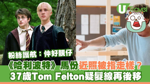 《哈利波特》馬份近照被指走樣？37歲Tom Felton疑髮線再後移 粉絲護航：仲好靚仔