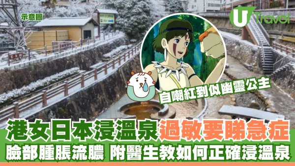 港女日本浸溫泉敏感要睇急症 臉部腫脹流膿 附醫生教如何正確浸溫泉