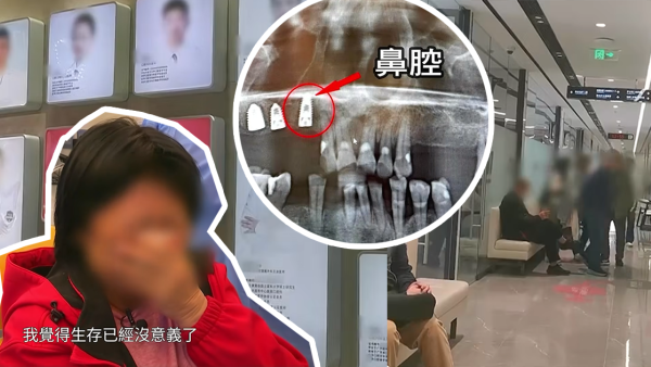 北上睇牙慘中伏！港婦花近6萬元種牙搞到周身痛？內地牙醫第一時間竟是推卸責任...