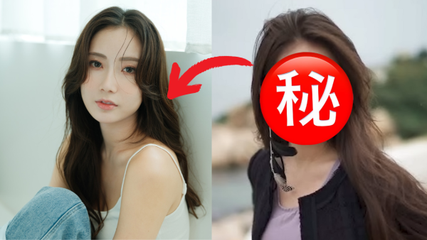 「拜金港姐」蔡嘉欣驚爆爛面恐怖黑歷史 坦白公開10年醫美史闊面變化極大