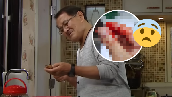 港人洗魚頭𠝹傷成手血 驚揭內藏「刀片」！網民憂染食肉菌籲求醫：魚鰭插手 差啲要做手術！