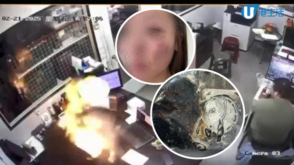 磁吸式尿袋突爆炸致台女臉燒傷 生產商急召回兩產品 港網店有售