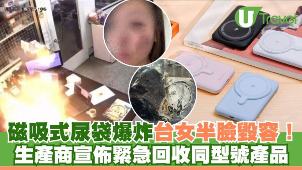 台灣磁吸式尿袋爆炸 29歲女半臉燒傷毀容！同型號產品需緊急回收