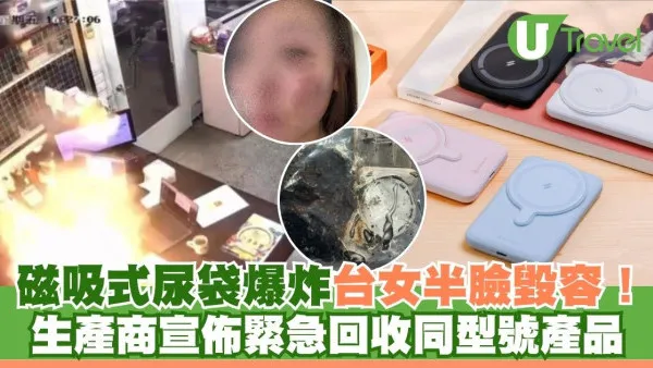 台灣磁吸式尿袋爆炸 29歲女半臉燒傷毀容！同型號產品需緊急回收