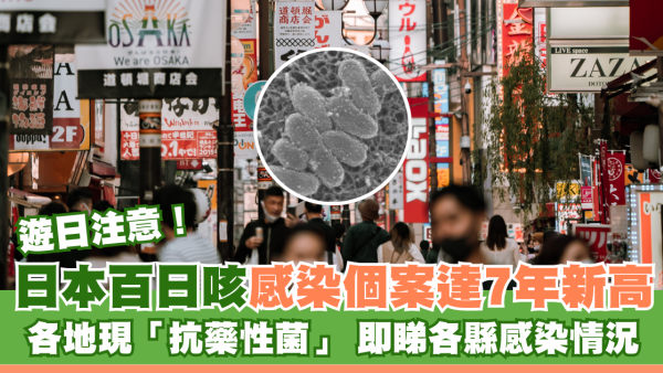 日本百日咳｜日本百日咳感染個案達7年新高 各地現「抗藥性菌」 即睇各縣感染情況