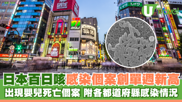 遊日注意｜日本百日咳感染個案創單週新高 出現嬰兒死亡個案 附各都道府縣感染情況