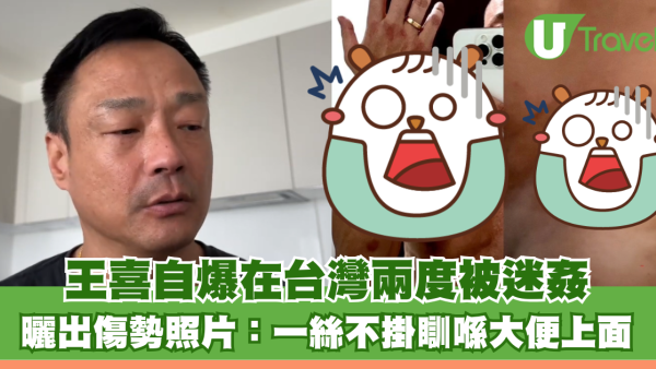 王喜自爆在台灣兩度被迷姦 曬出傷勢照片：一絲不掛瞓喺大便上面